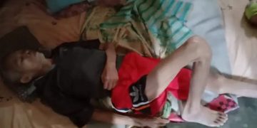 Penderita Lumpuh Menahun Di TuBaBa Butuh Perhatian Pemerintah