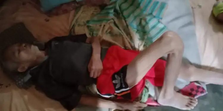 Penderita Lumpuh Menahun Di TuBaBa Butuh Perhatian Pemerintah