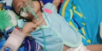 Abdallah Bayi Penderita Jantung Bocor Harapkan Perhatian Pemkab Tulang Bawang Barat