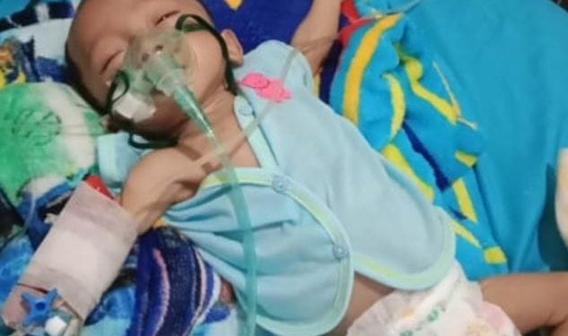Abdallah Bayi Penderita Jantung Bocor Harapkan Perhatian Pemkab Tulang Bawang Barat